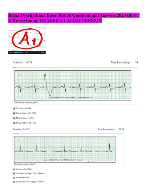 relias basic dysrhythmia test a